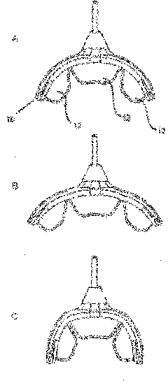 Mouthpiece and methods for effecting an oral treatment