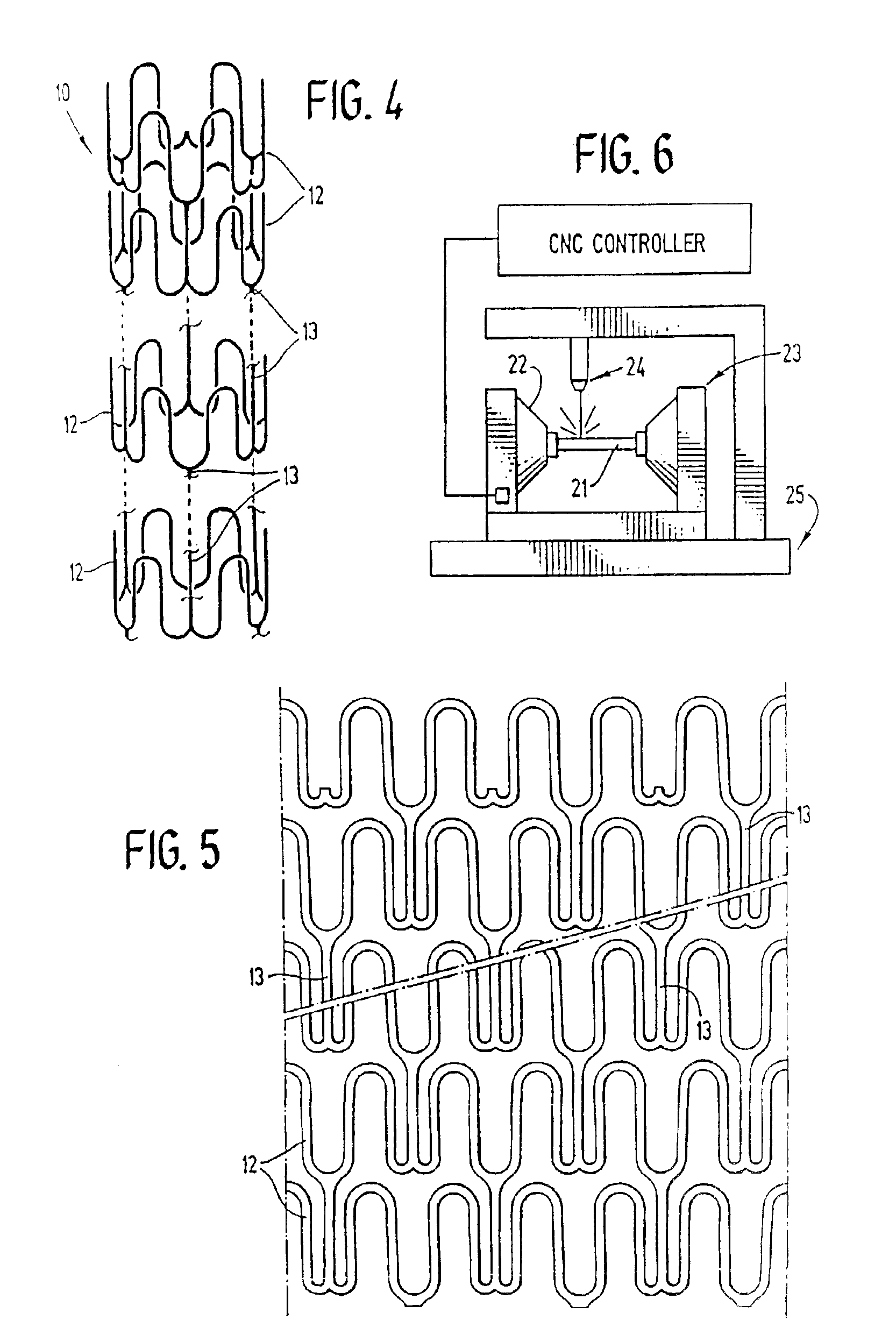 Expandable stents and method for making same