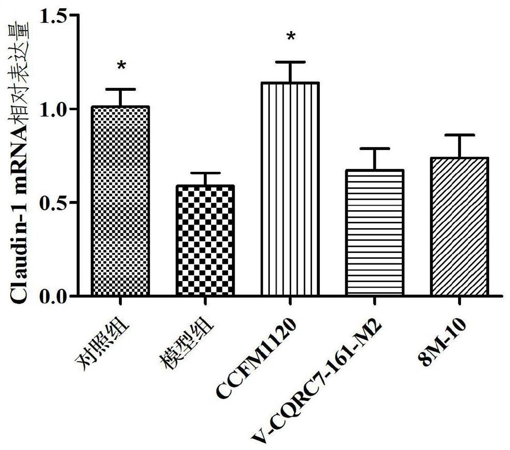Lactobacillus paracasei capable of relieving alcoholic intestinal injury and application of lactobacillus paracasei capable of relieving alcoholic intestinal injury