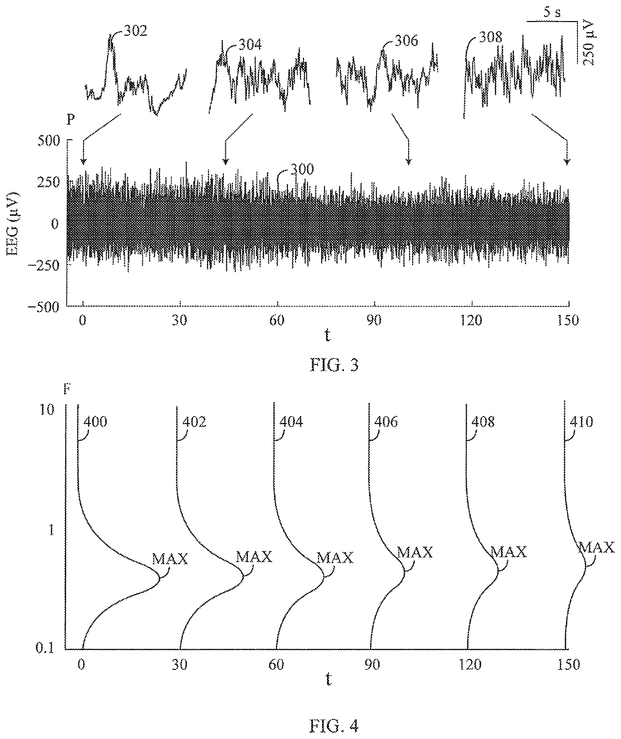 Apparatus and method for electroencephalographic examination