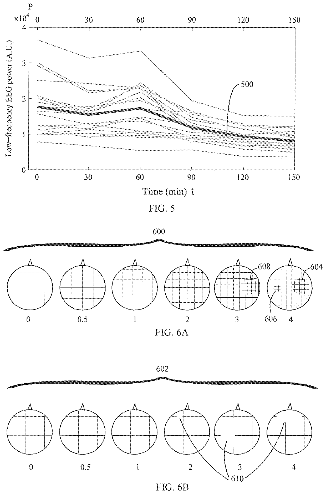 Apparatus and method for electroencephalographic examination