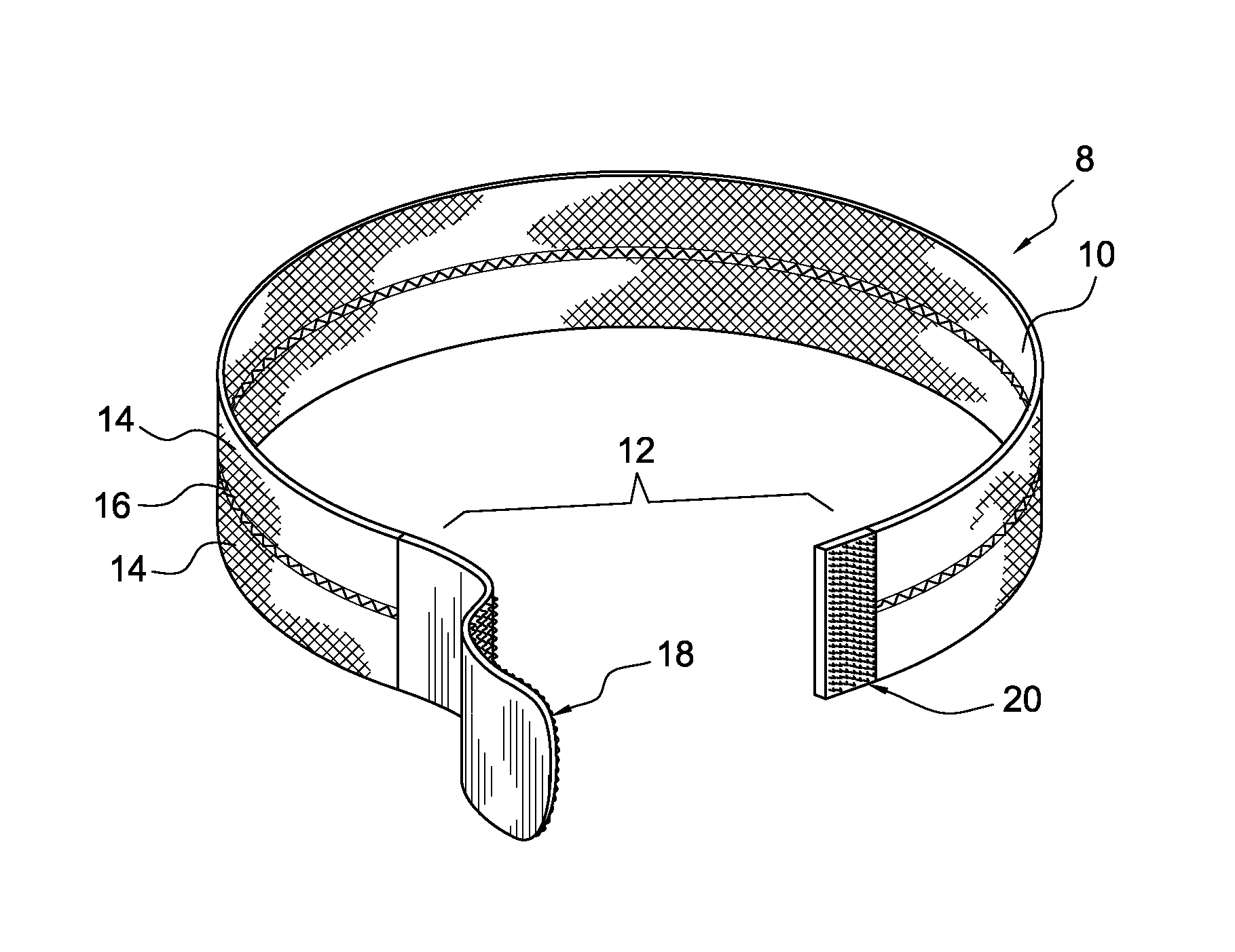 Method and apparatus for tensile colonoscopy compression