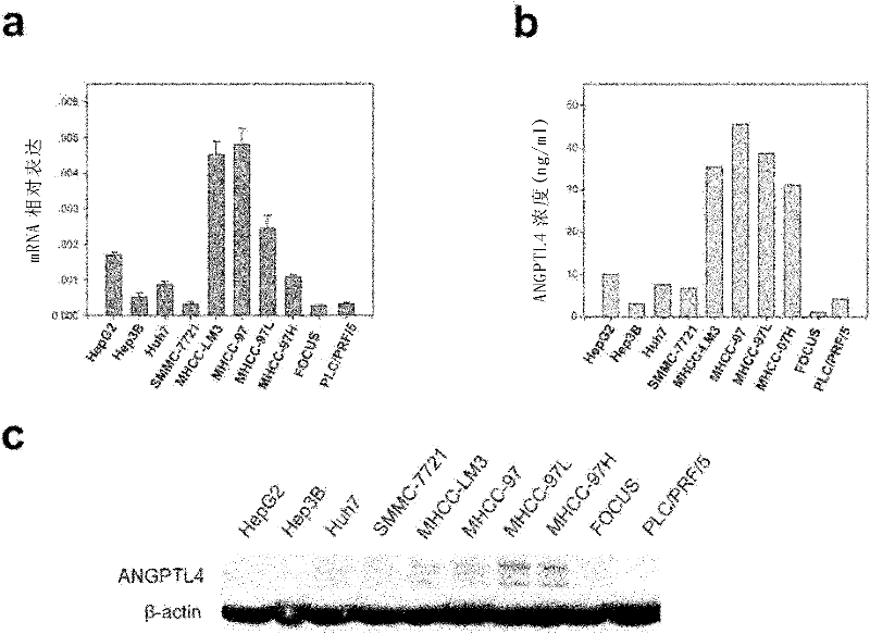 ANGPTL4 as a marker of liver cancer metastasis by serological detection and application thereof