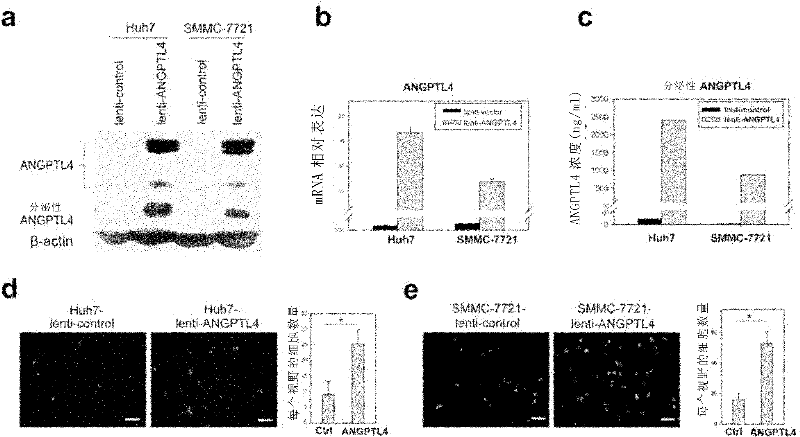 ANGPTL4 as a marker of liver cancer metastasis by serological detection and application thereof