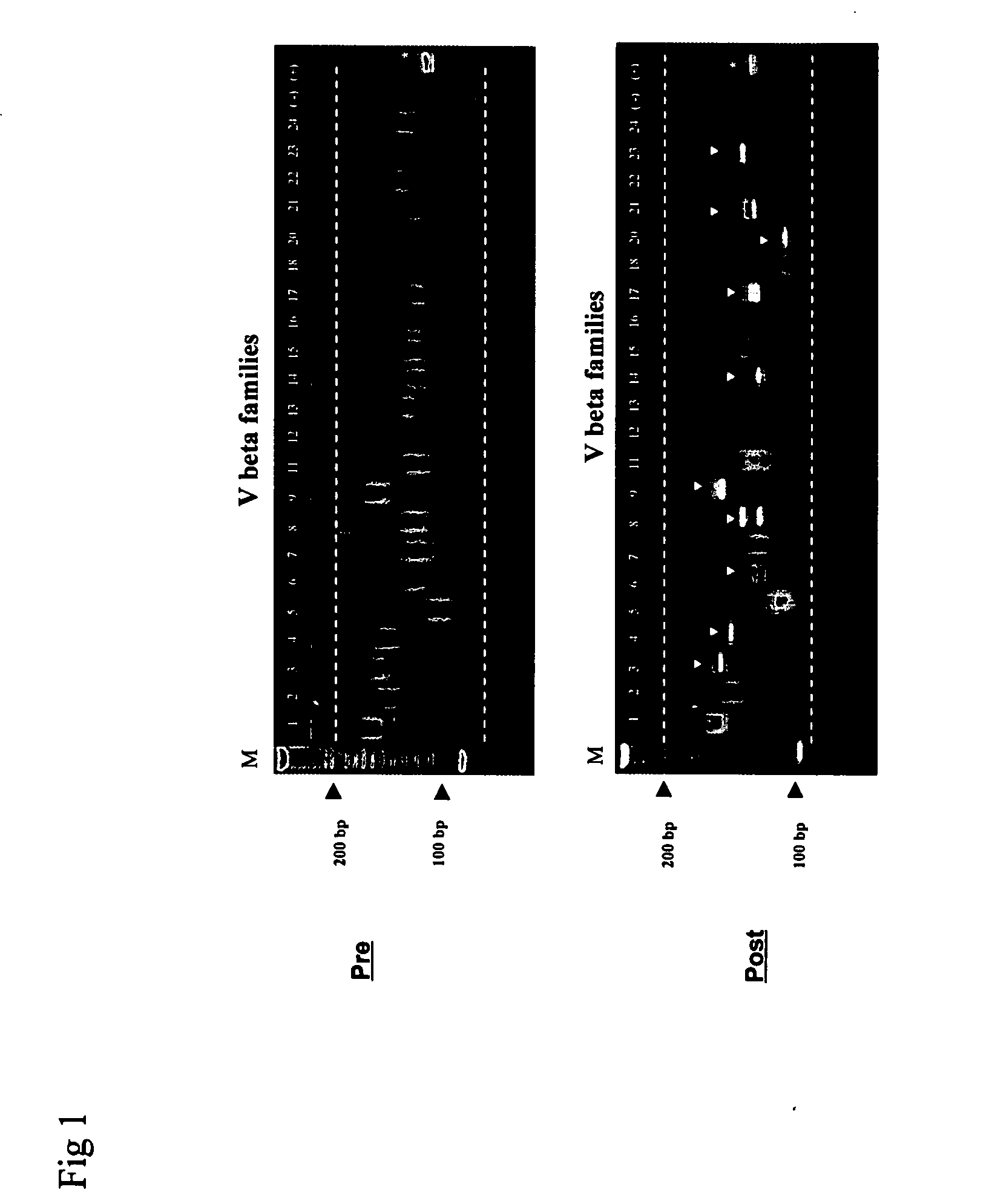 Method for detection and quantification of T-cell receptor Vbeta repertoire