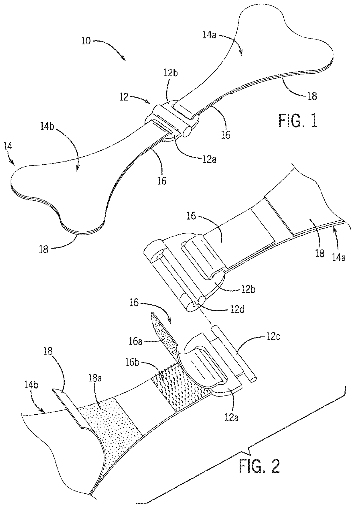 Nasogastric tube stabilization system