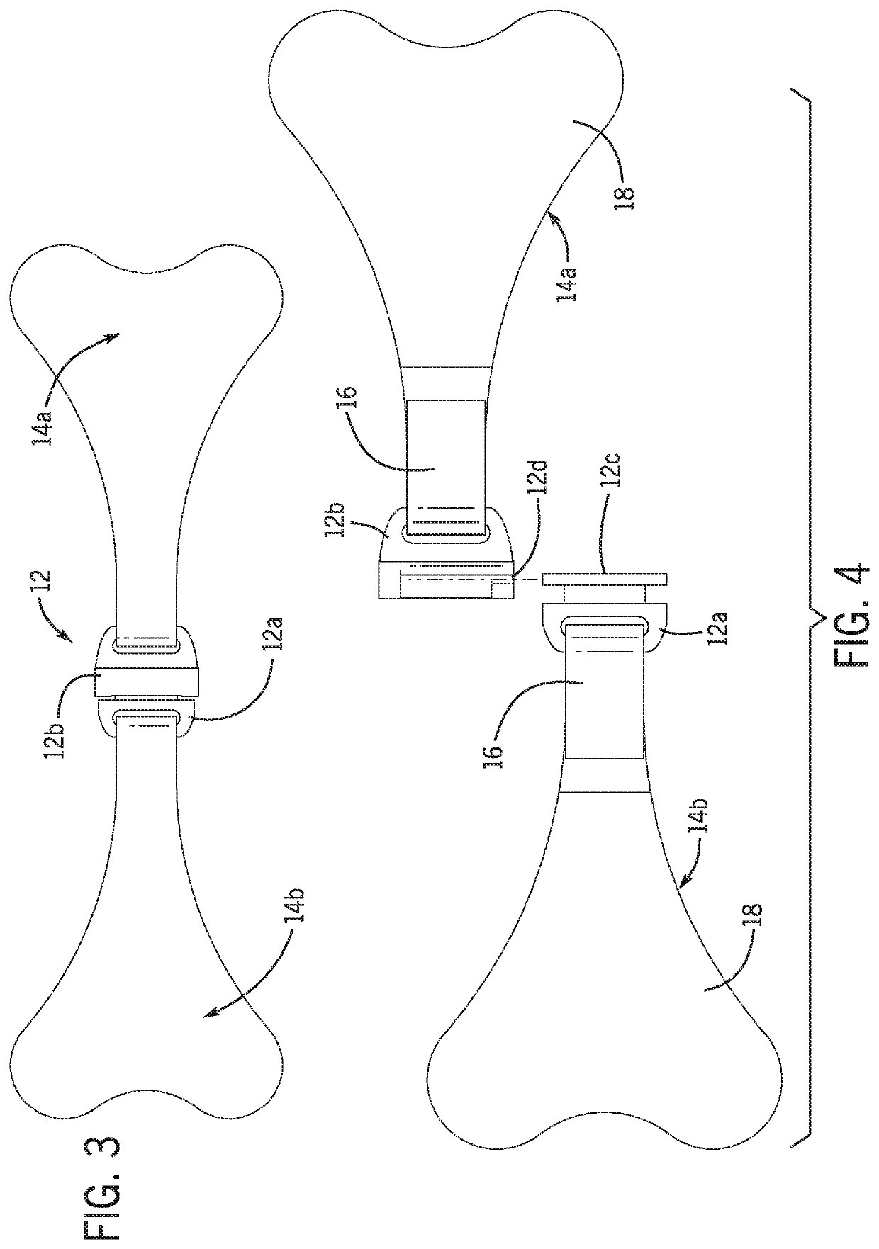 Nasogastric tube stabilization system