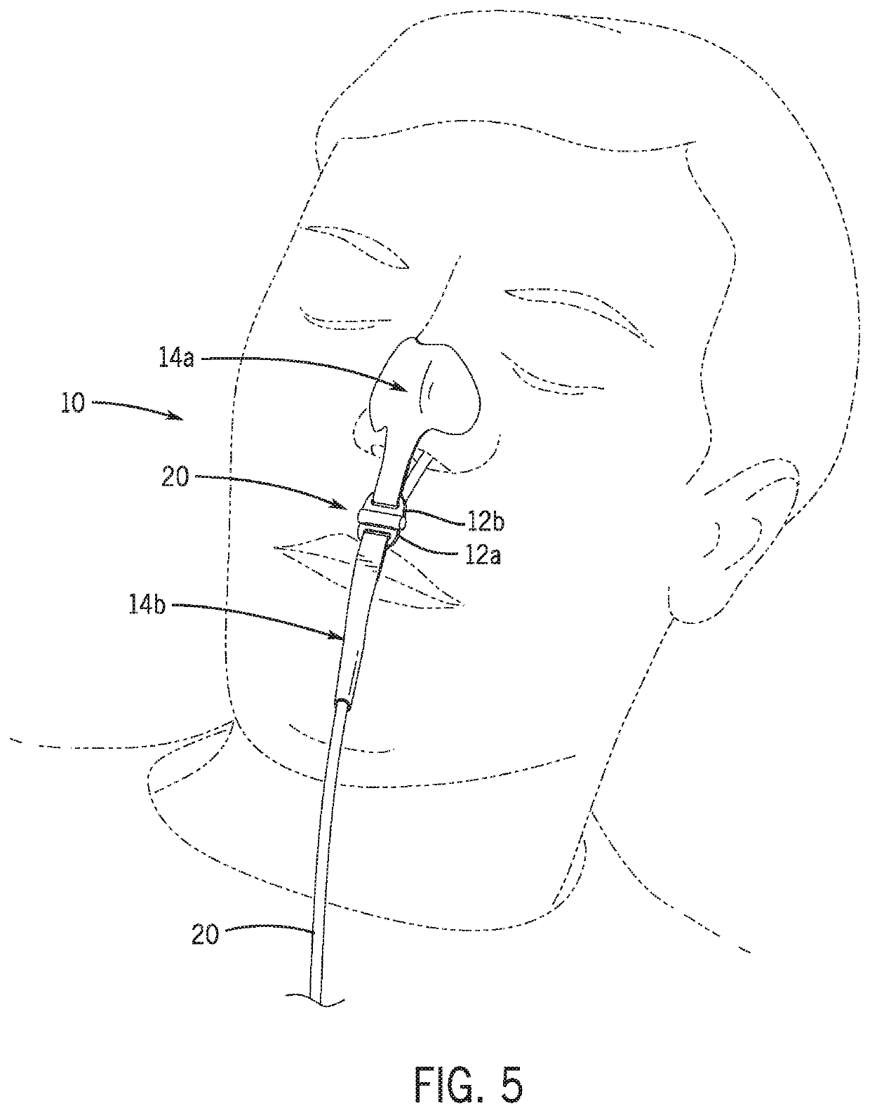 Nasogastric tube stabilization system