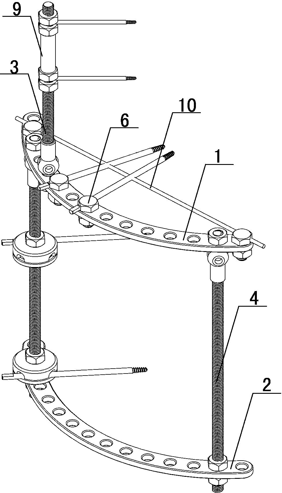 Activity-inertia combined adjusting control outer fixer for distal radius fracture