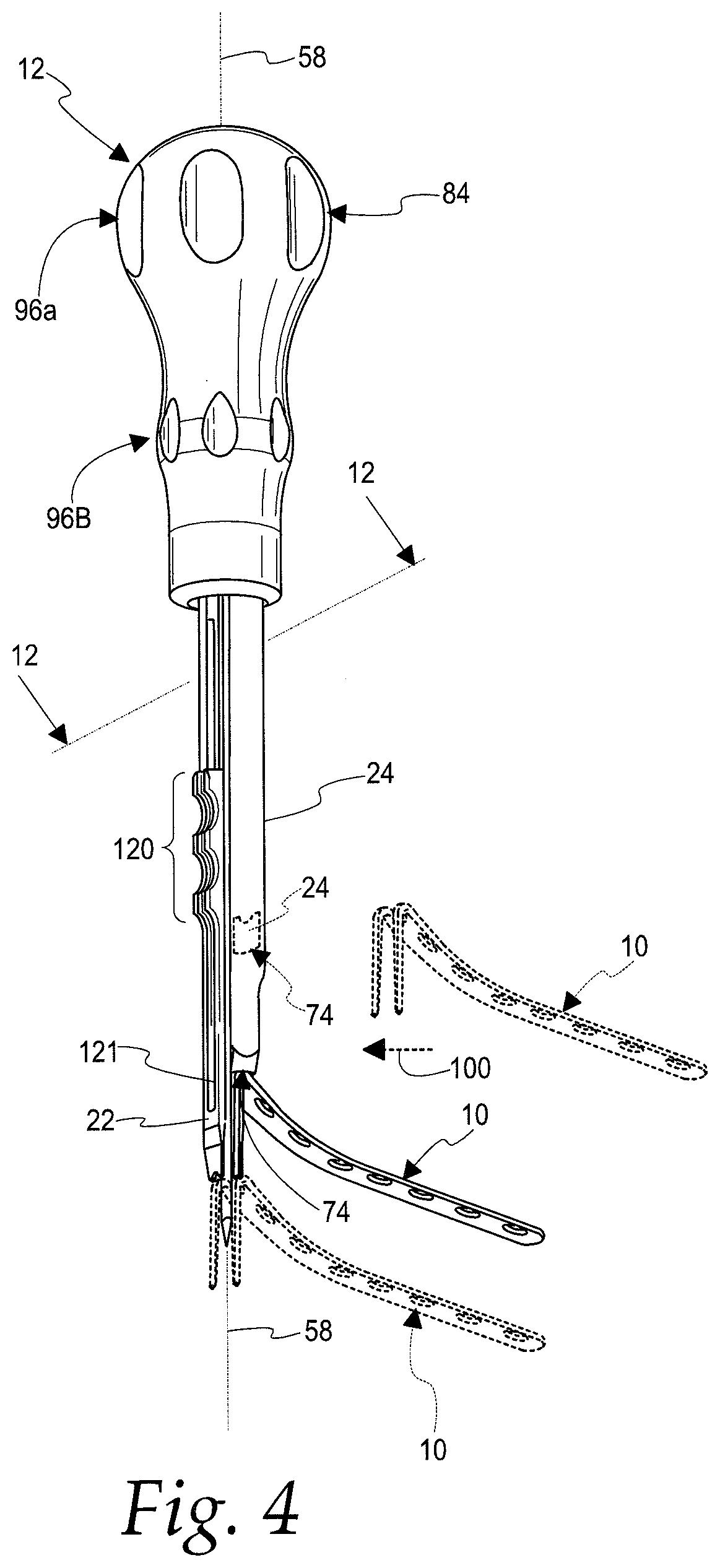 Bone implant handling instrument for placing a bone implant in an operative position
