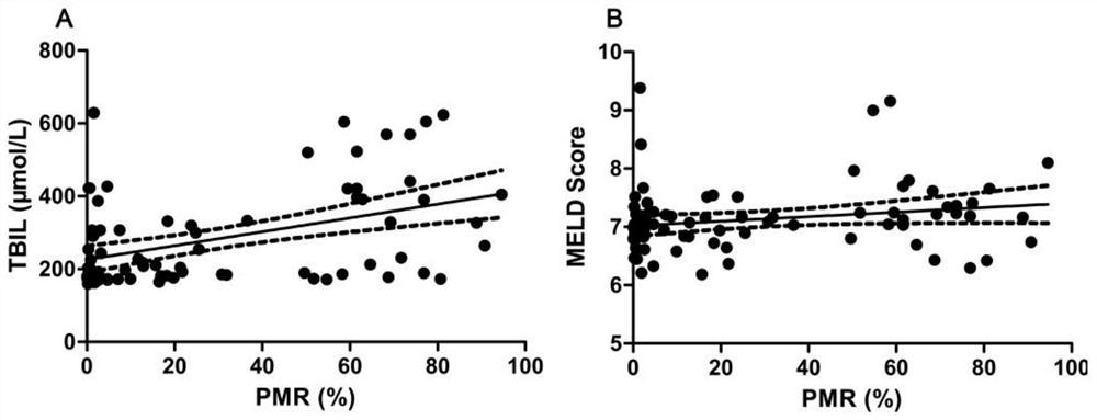 Biomarker for early detection of severe hepatitis B virus as well as detection kit and application thereof