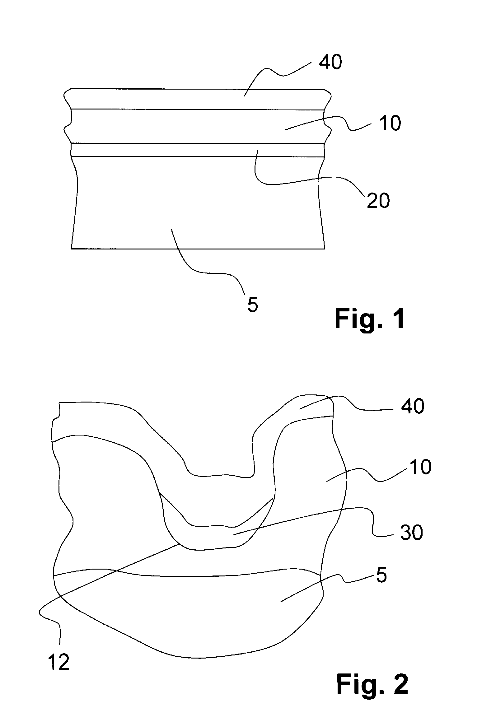 Implant and Method for Manufacturing Same