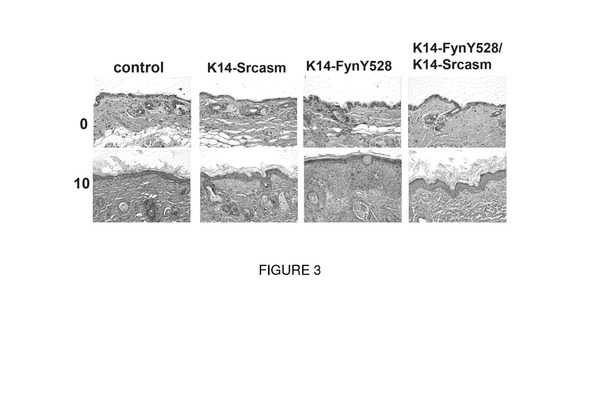 Compositions and methods for treating skin cancer associated diseases