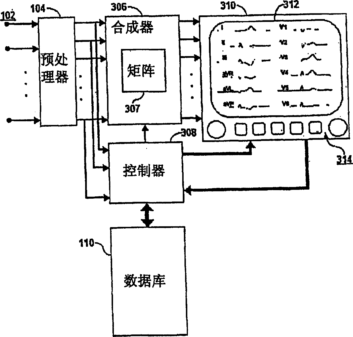 System for adaptively deriving ECG chest lead signal data