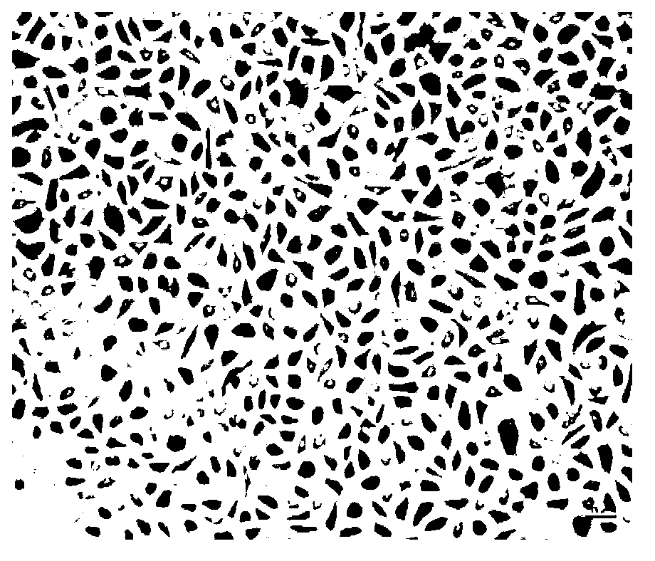 Large yellow croaker antimicrobial peptide hepcidin gene promoter sequence and application thereof