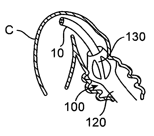 Apparatus and methods for achieving endoluminal access