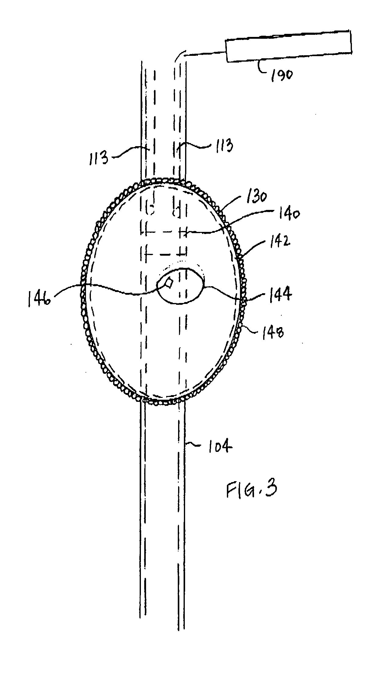 Biologic device for regulation of gene expression and method therefor