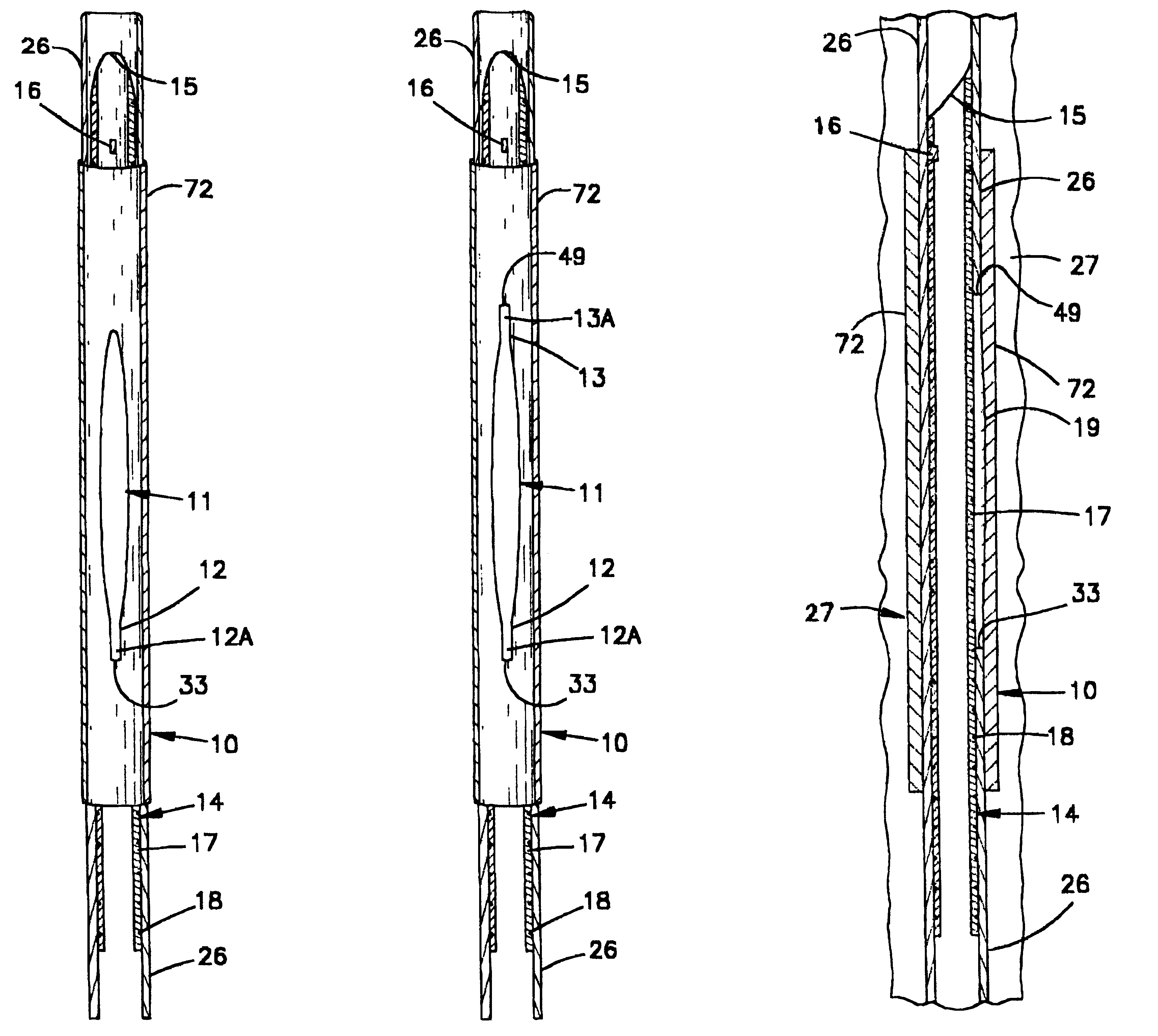 Assembly and method for providing a means of support and positioning for drilling multi-lateral wells and for reentry therein through a premilled window
