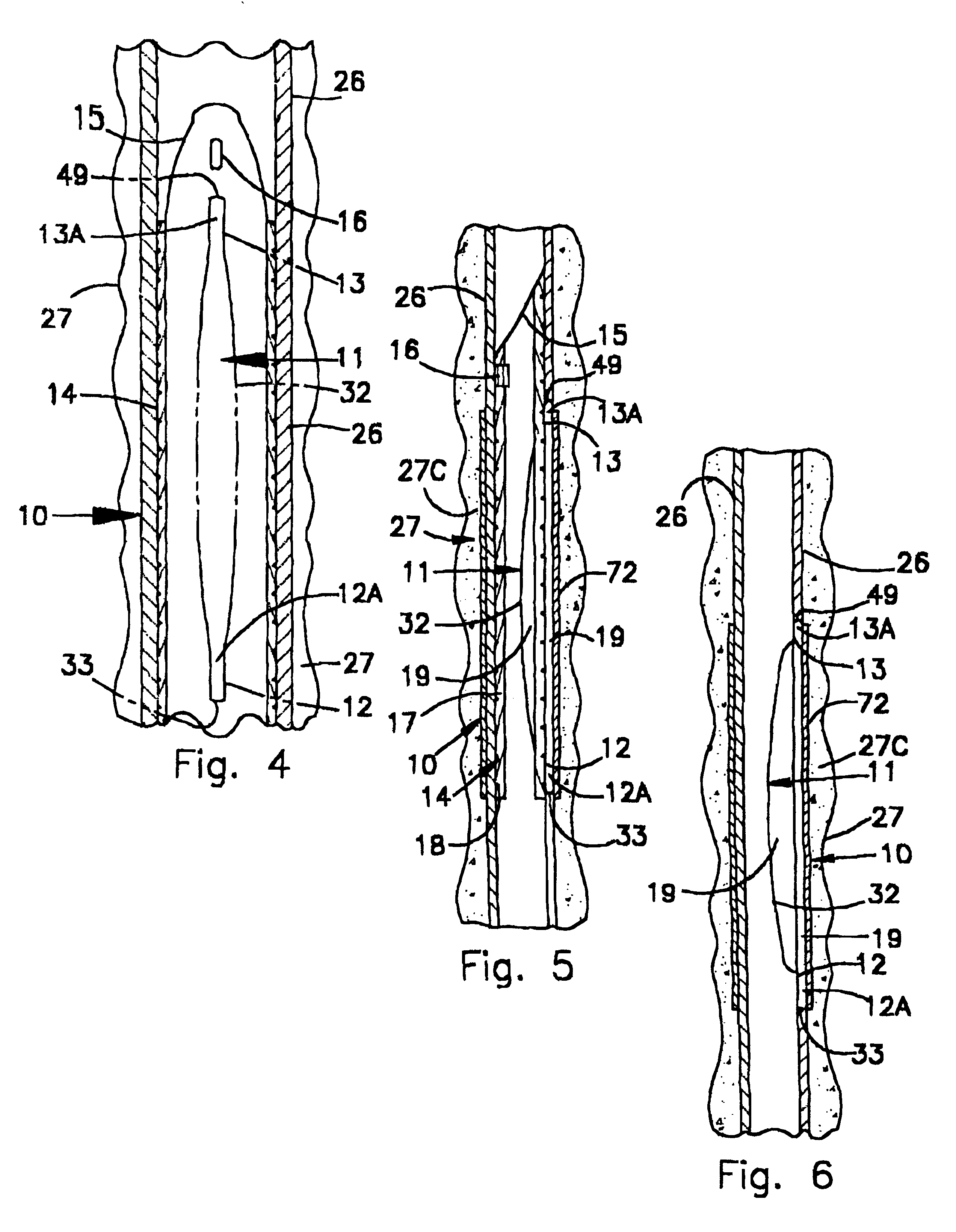 Assembly and method for providing a means of support and positioning for drilling multi-lateral wells and for reentry therein through a premilled window