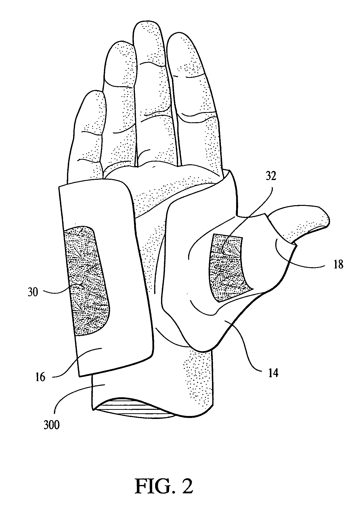 Adaptable apparatus and method for treating carpal tunnel syndrome