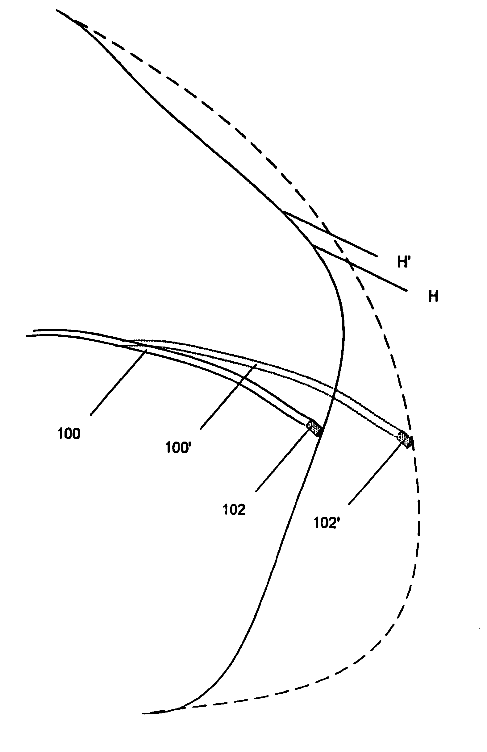 Electrophysiology catheter and system for gentle and firm wall contact