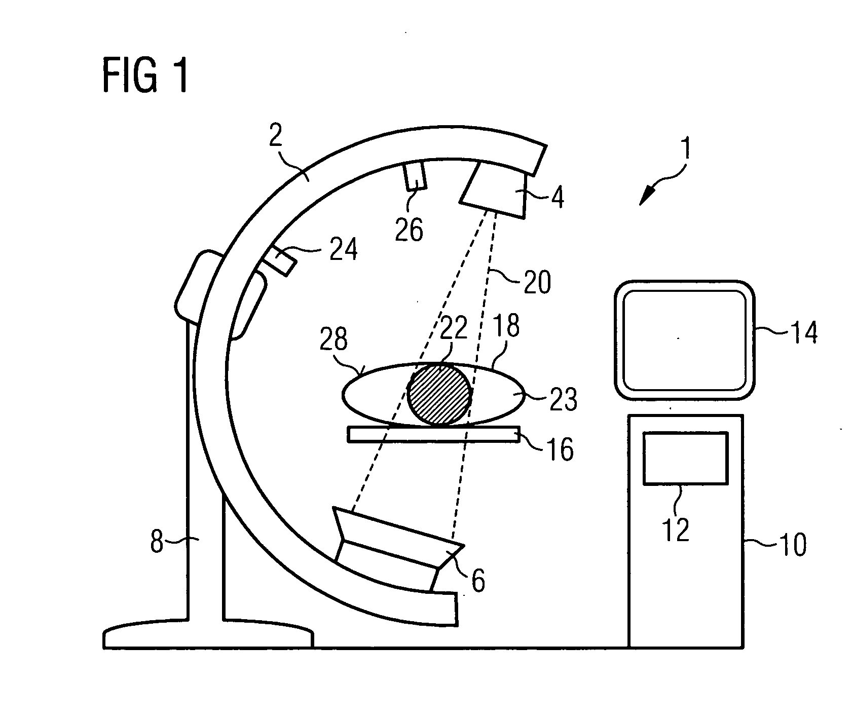 Method for minimizing image artifacts and medical imaging system