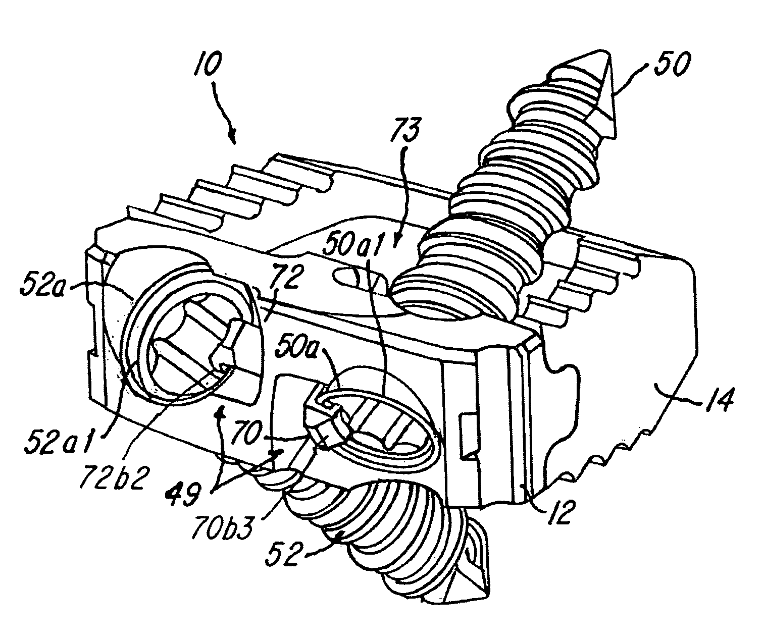 Spinal implant and assembly