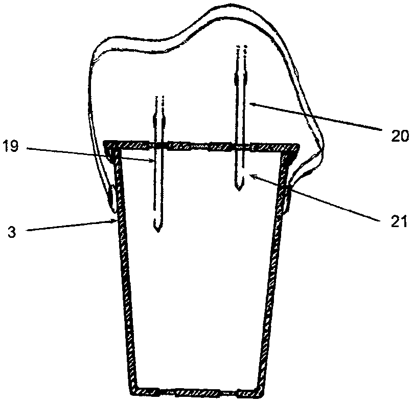 Rechargeable craniocerebral injury operation suction device for field operation emergency