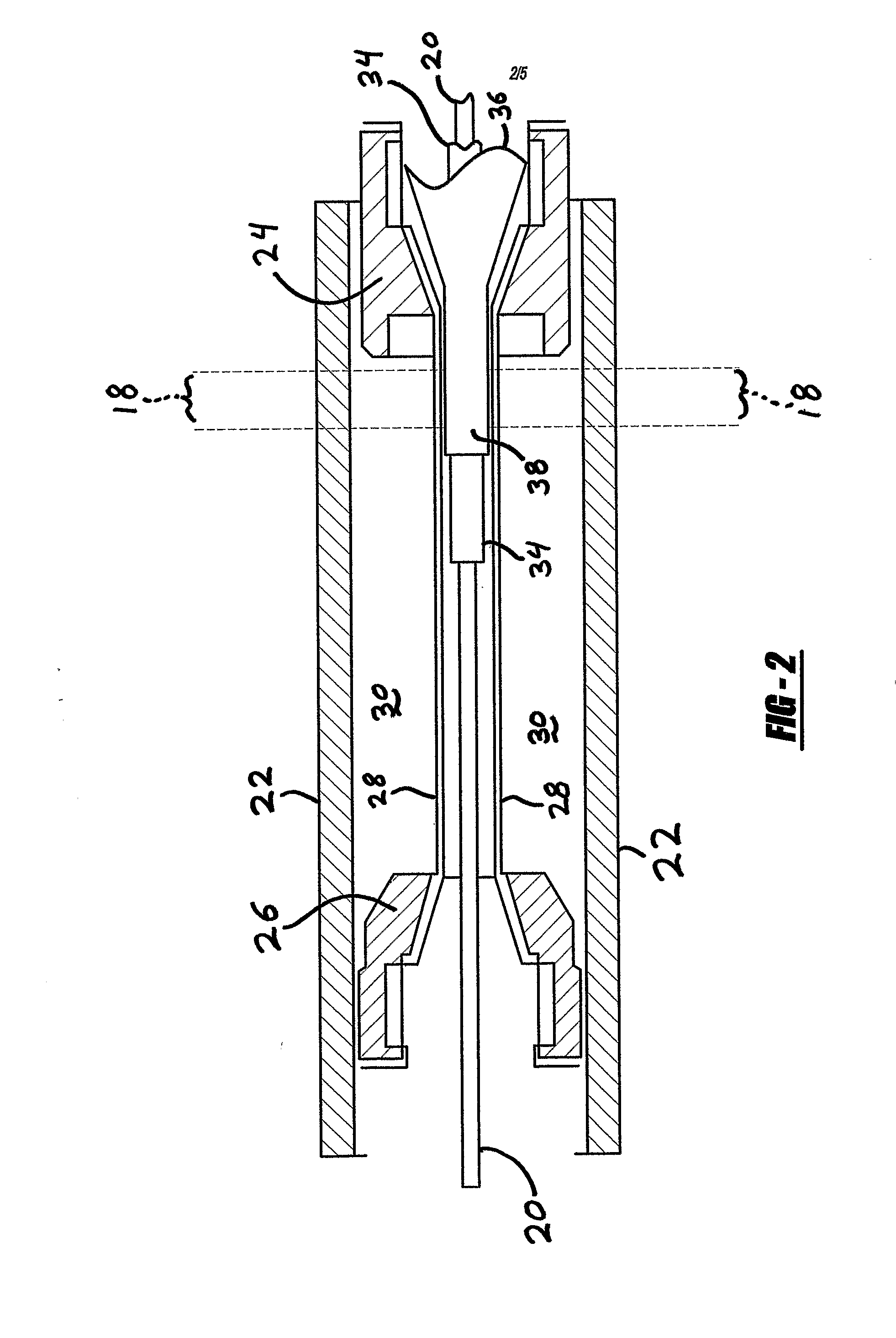 Systems and Methods for Laser Bonding Catheter Components