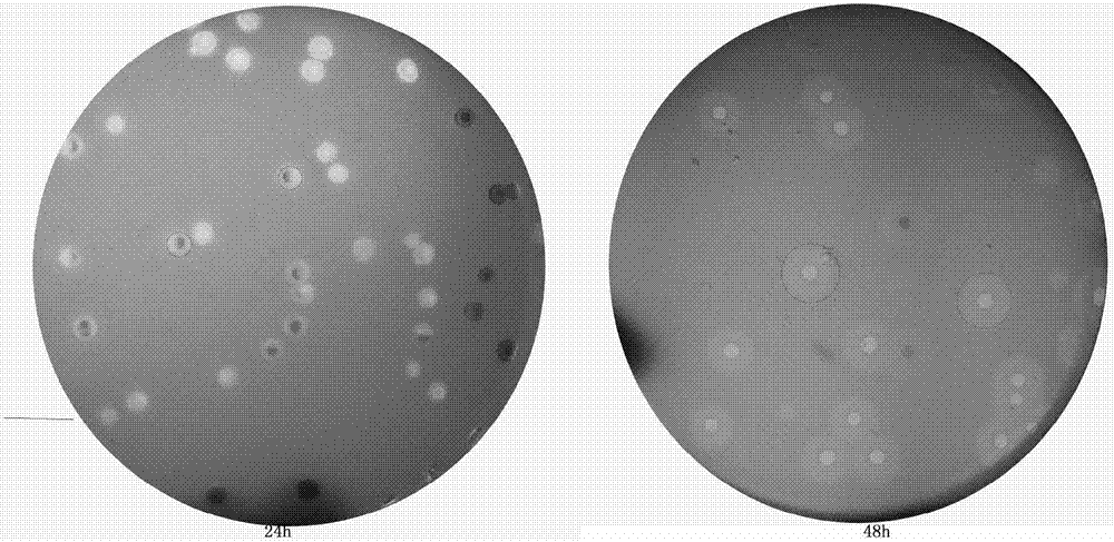 Pseudomonas aeruginosa phage and application thereof