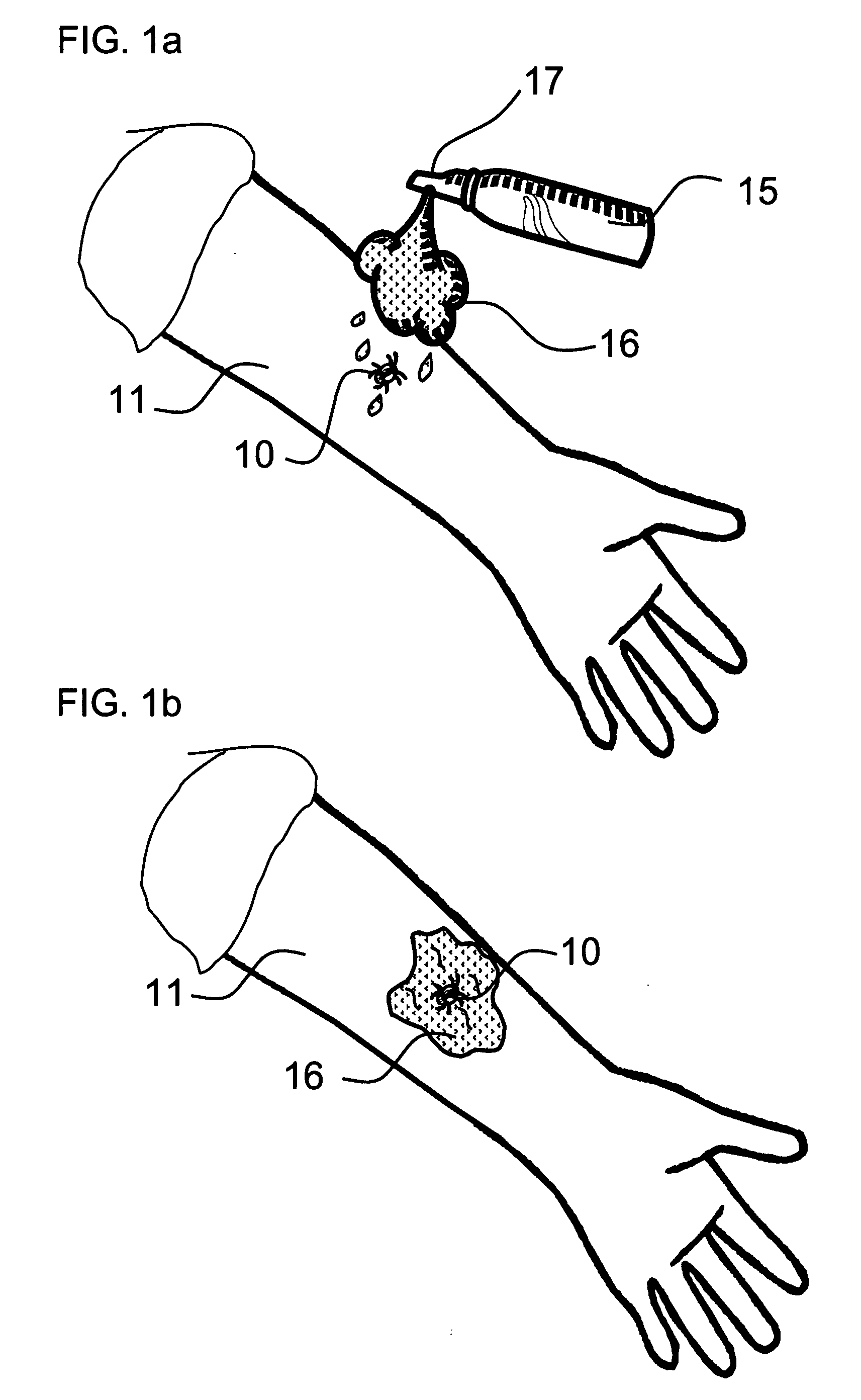 Insect removal tape, debilitating spray formulation and method for using same