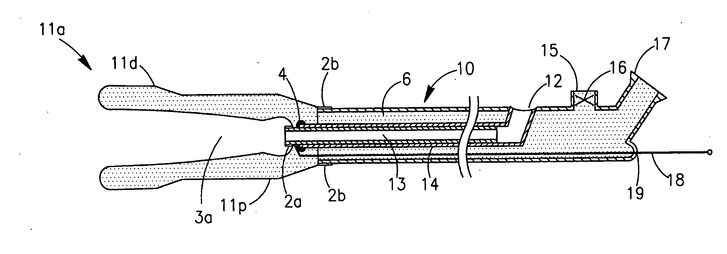 Intussuscepting balloon catheter and methods for constructing and using thereof