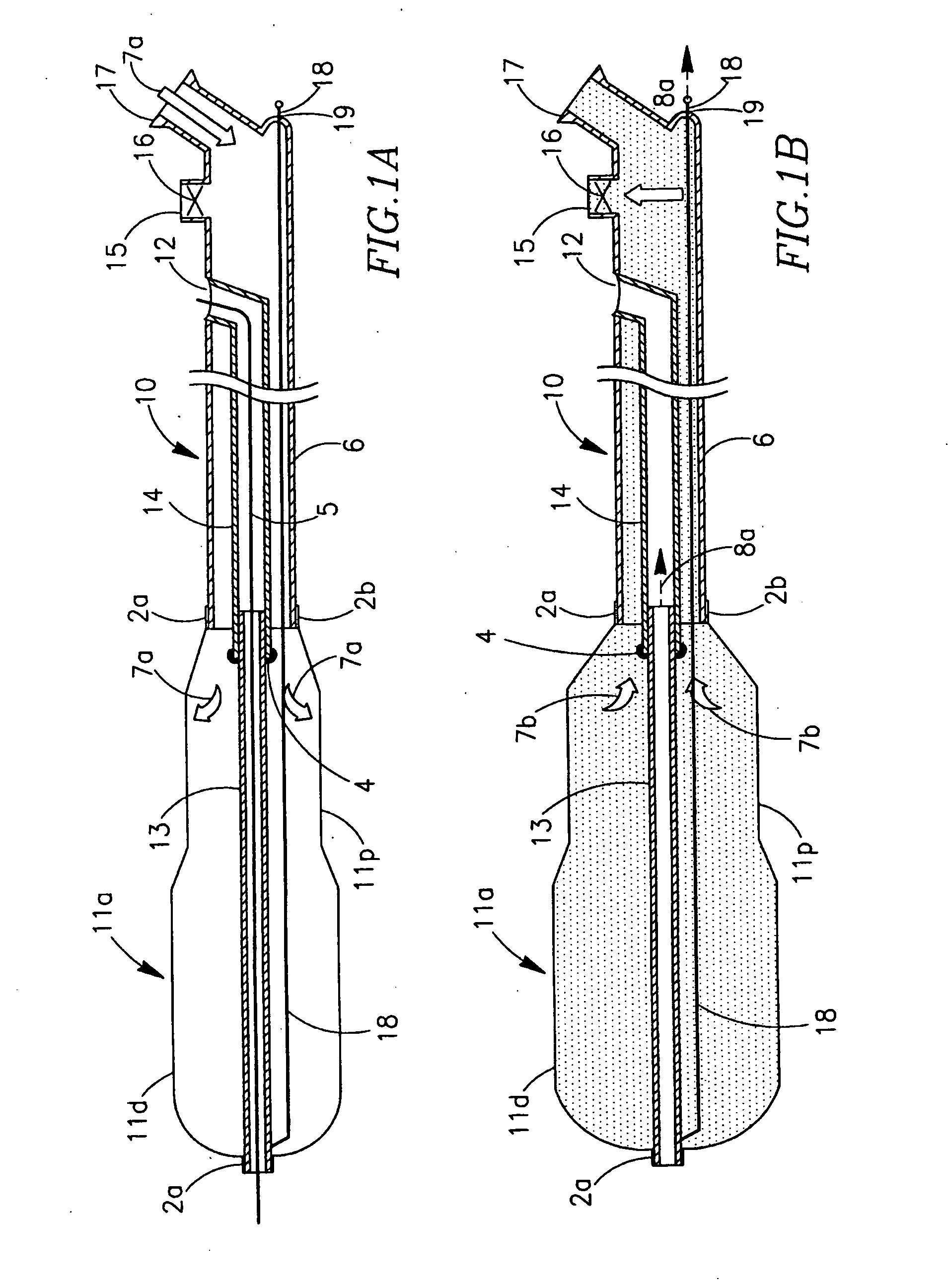 Intussuscepting balloon catheter and methods for constructing and using thereof