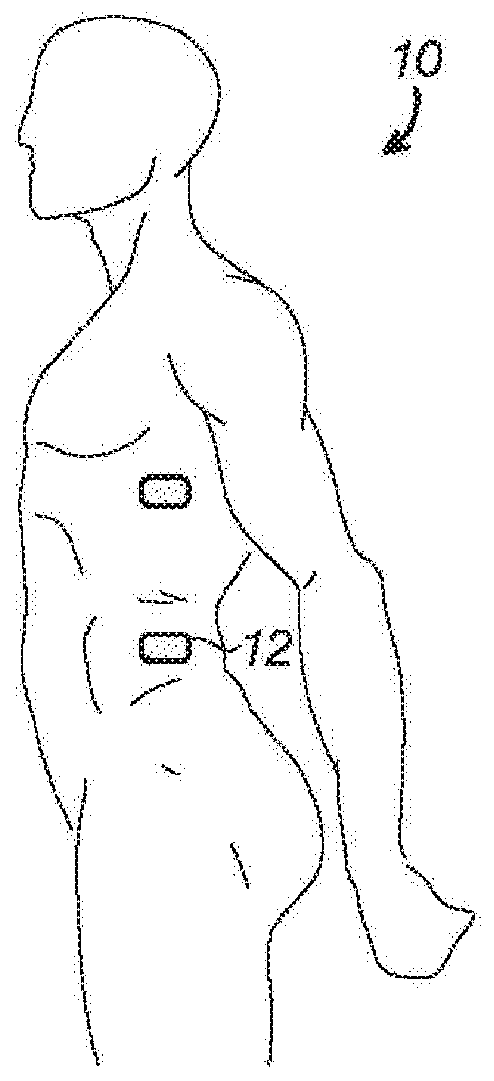 Wearable physiological monitoring systems and methods