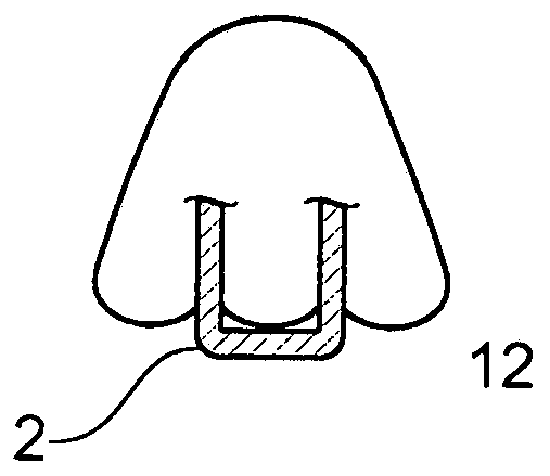 A nasal delivery system