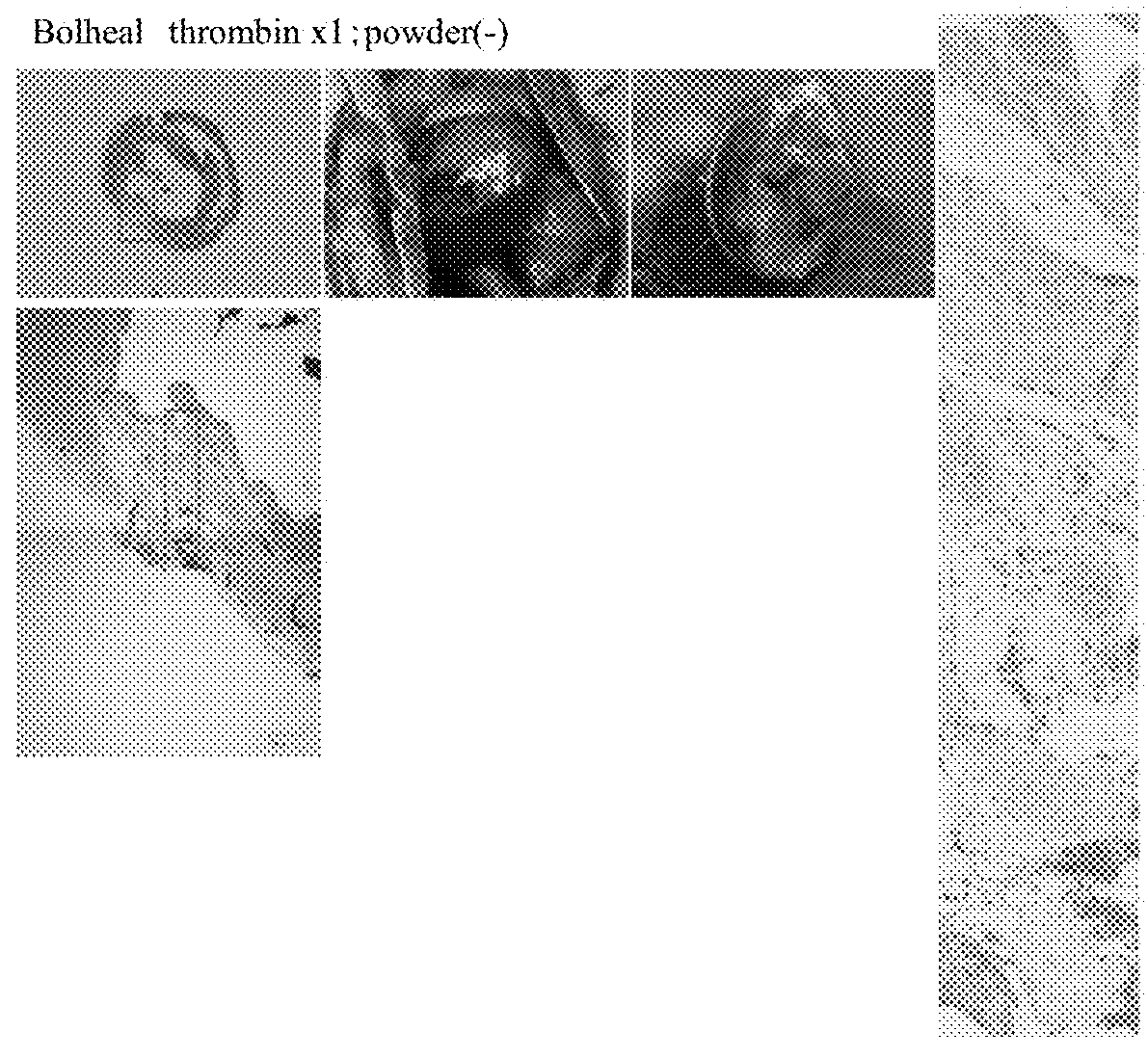 Hybrid gel comprising particulate decellularized tissue