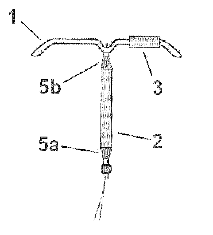 Intrauterine delivery system for contraception