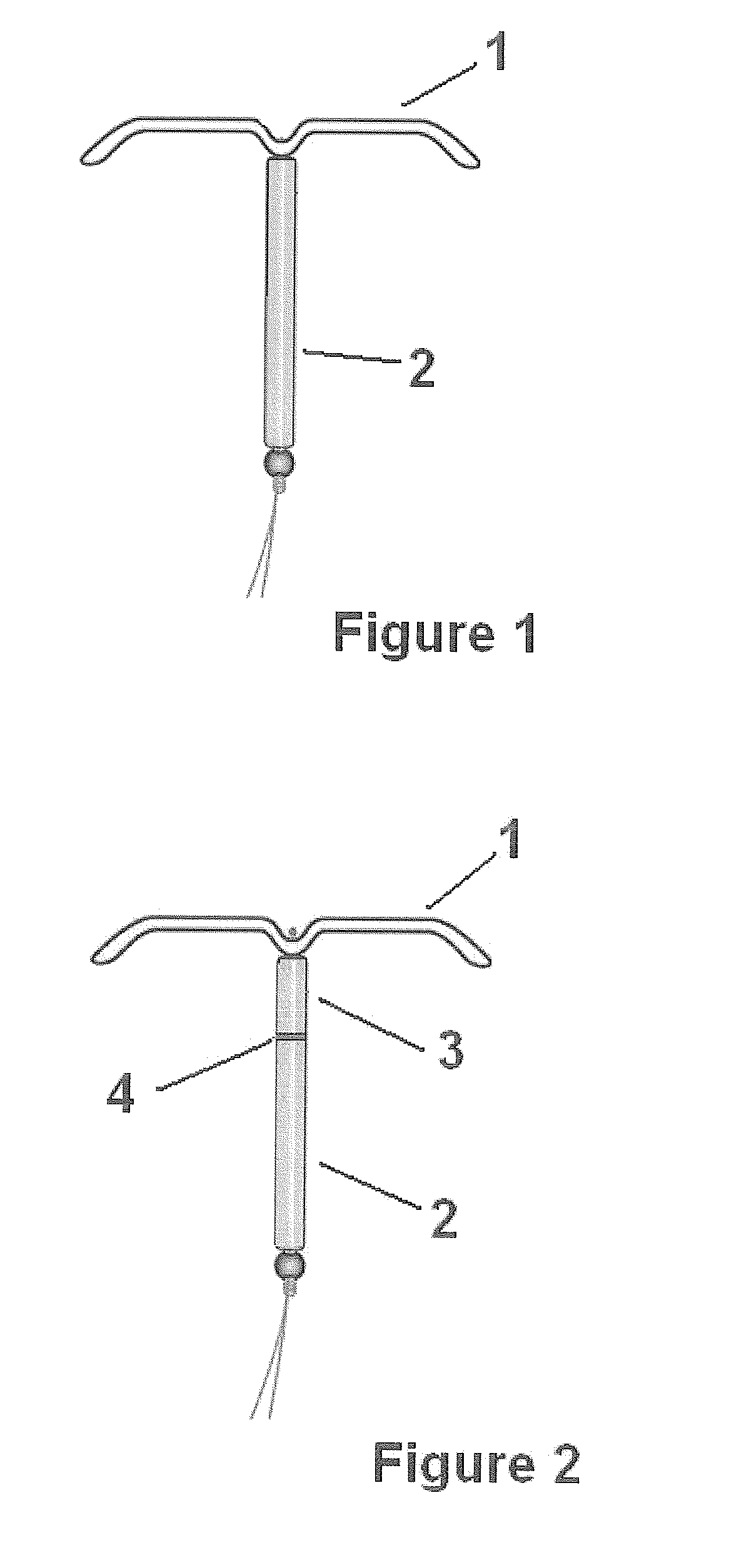 Intrauterine delivery system for contraception