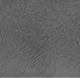 MSC modified by exendin-4 fusion gene and its application