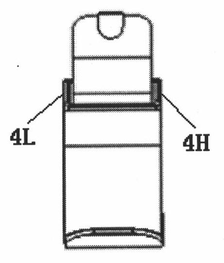 Carbon fiber energy storage pseudarthrosis prosthetic feet