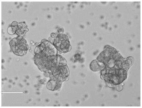 Preparation method of separation tube for separating tumor cells