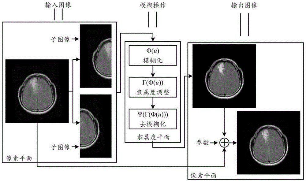 An Image Enhancement Method Based on Intuitionistic Fuzzy Sets