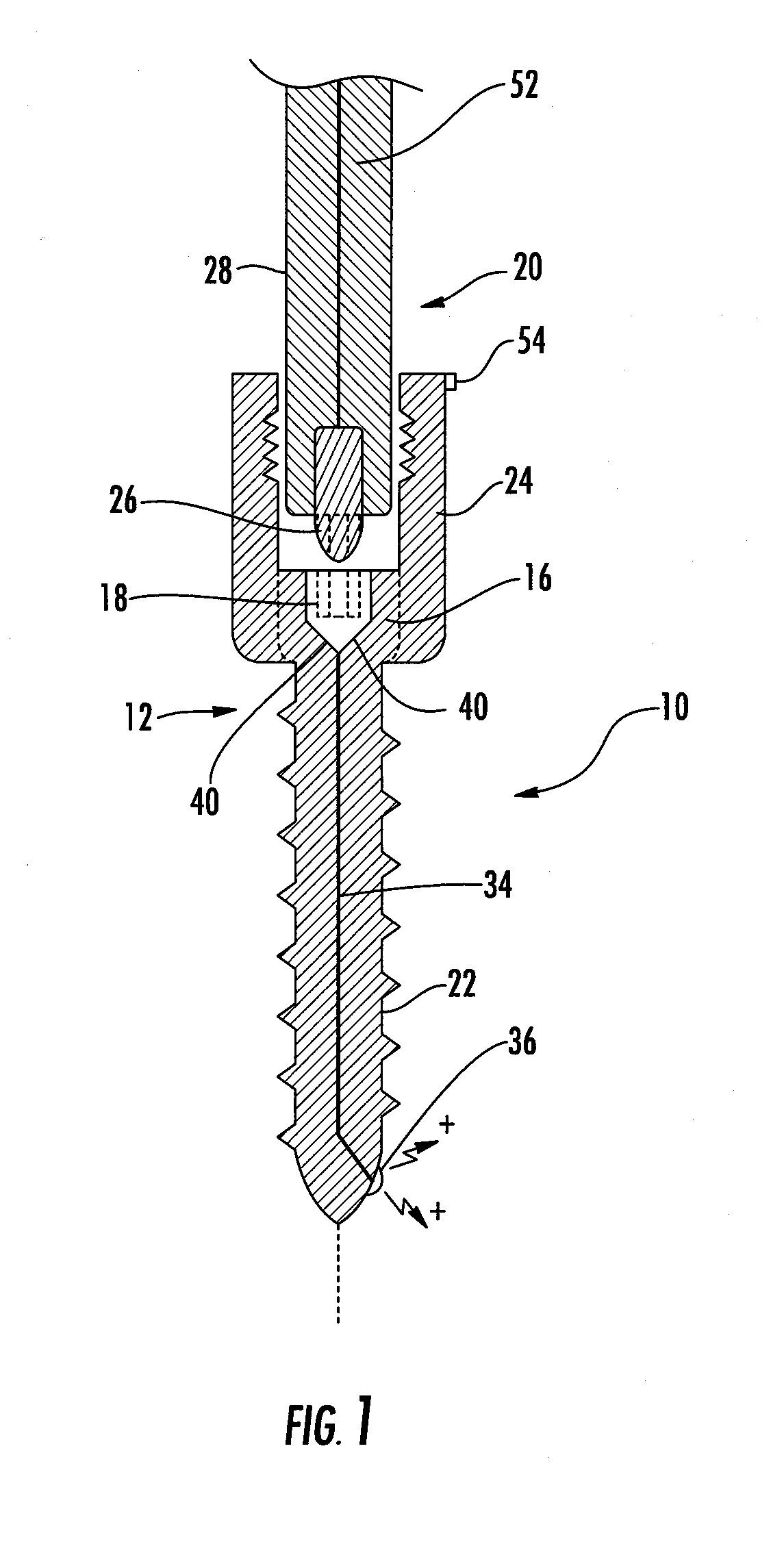 Implant equipped for nerve location and method of use