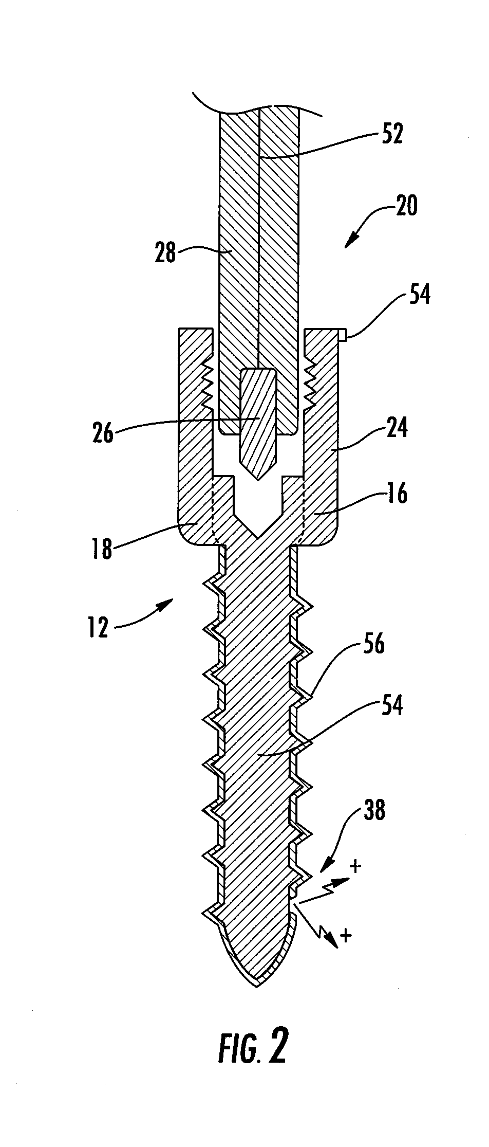 Implant equipped for nerve location and method of use