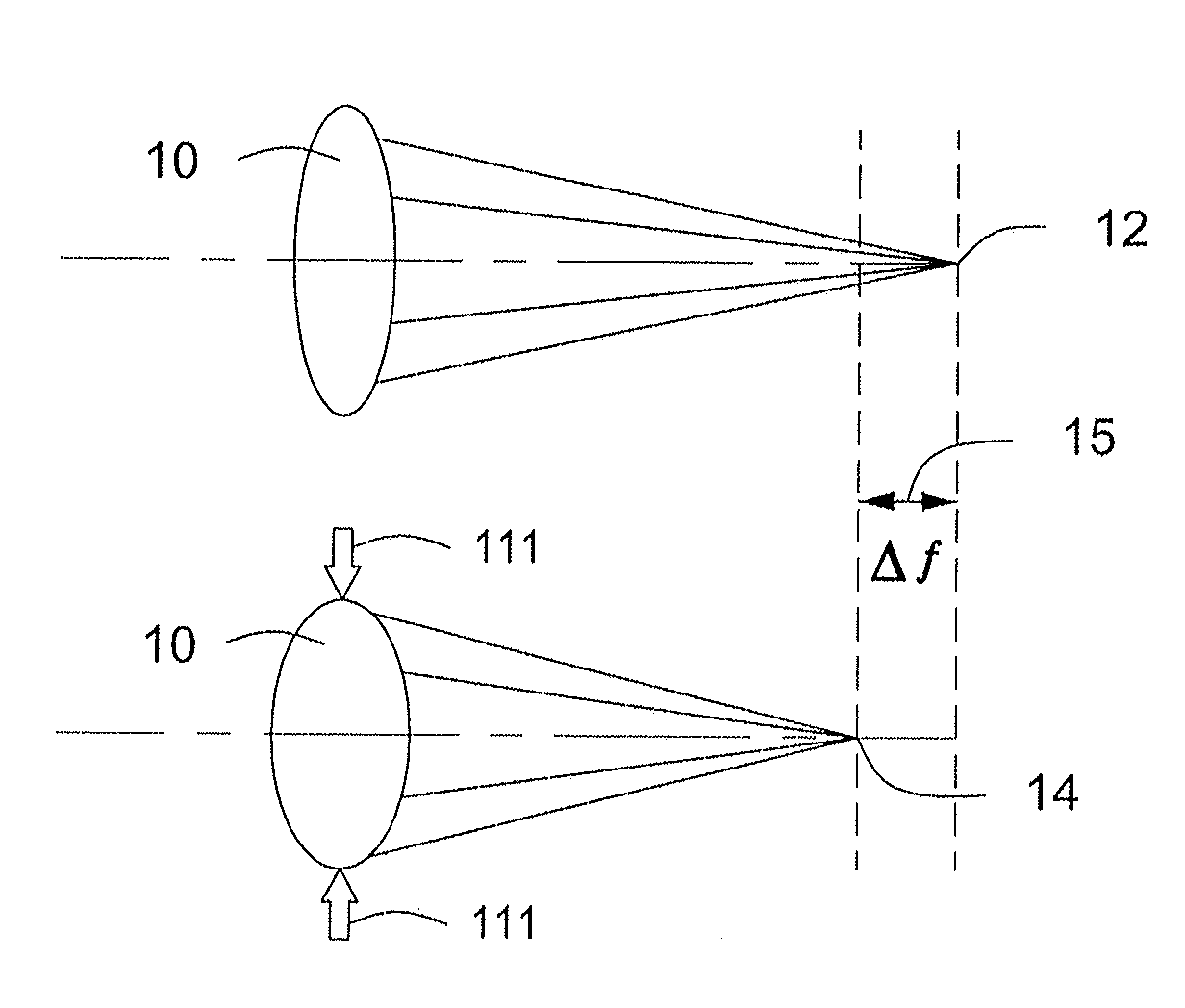 Deformable accommodative intraocular lens