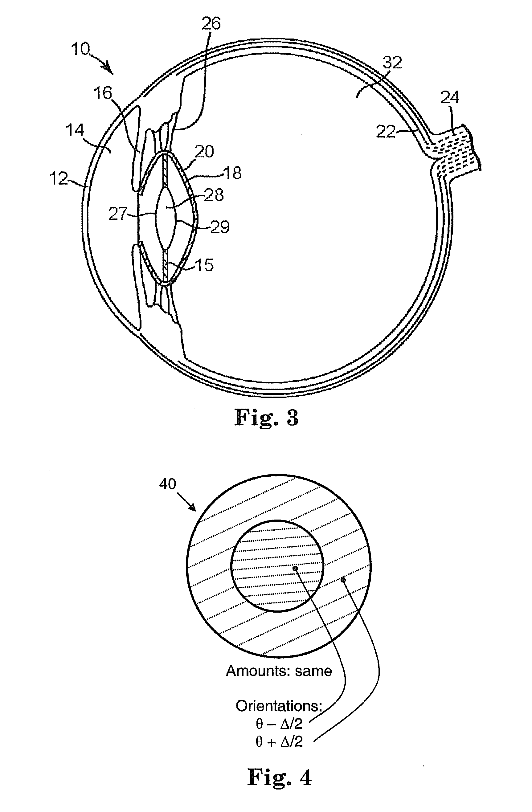 Toric intraocular lens with modified power characteristics