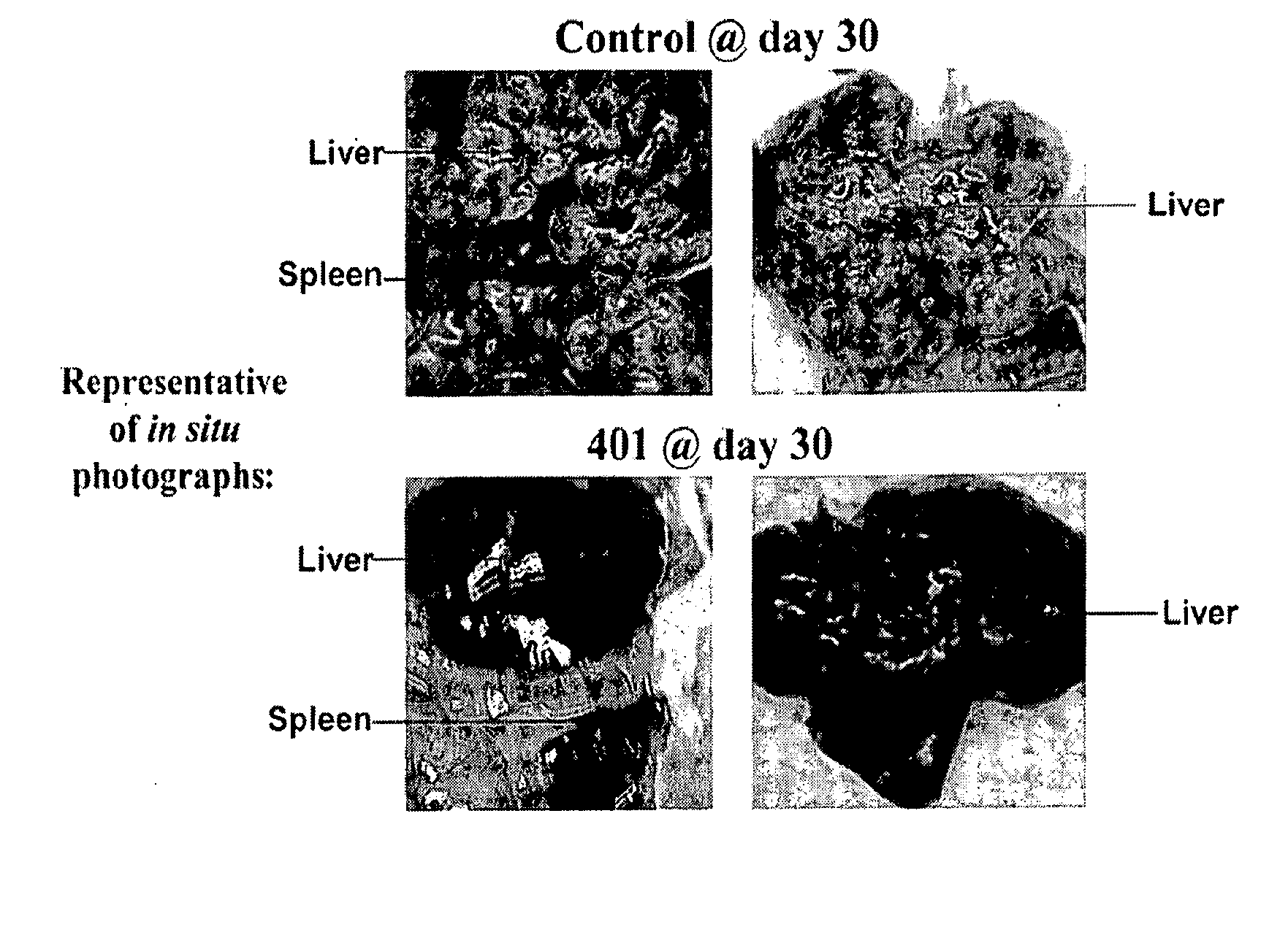 Novel compositions and methods for cancer treatment