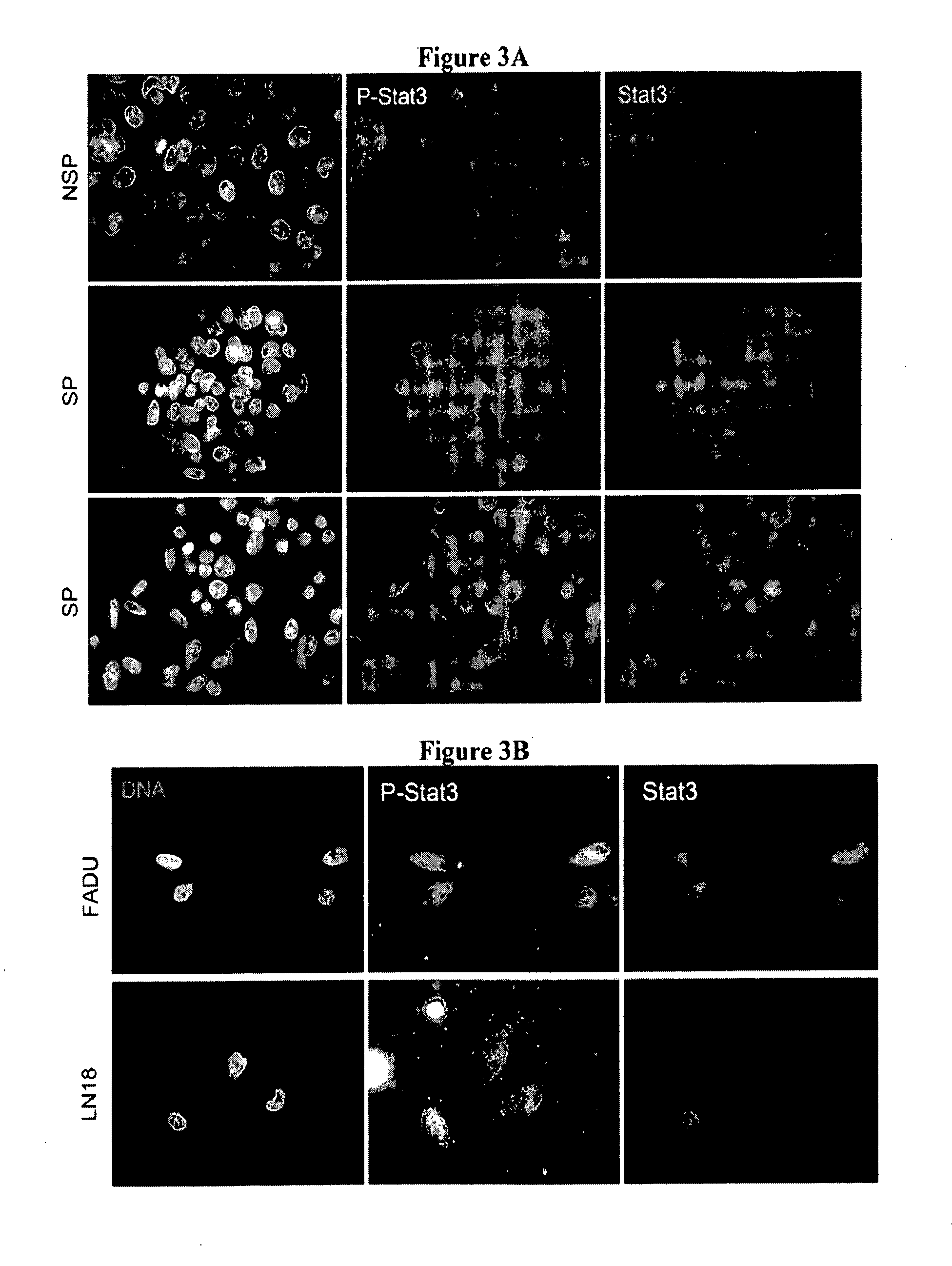 Novel compositions and methods for cancer treatment