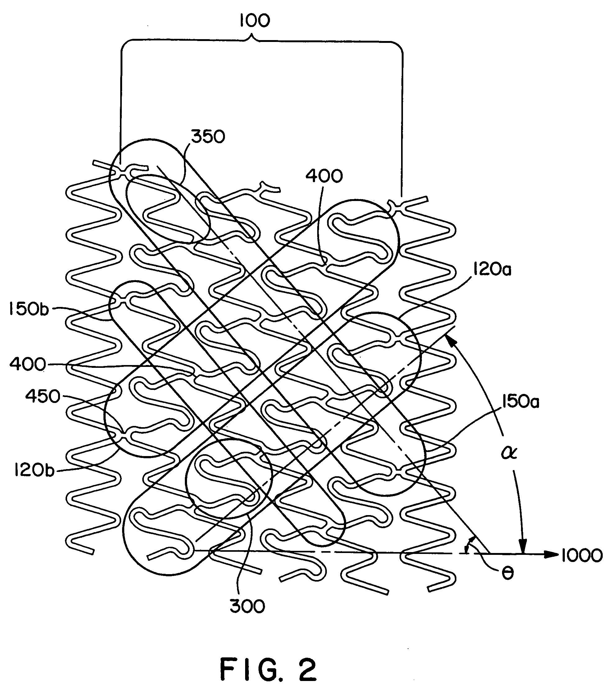 Crimpable intraluminal endoprosthesis having helical elements