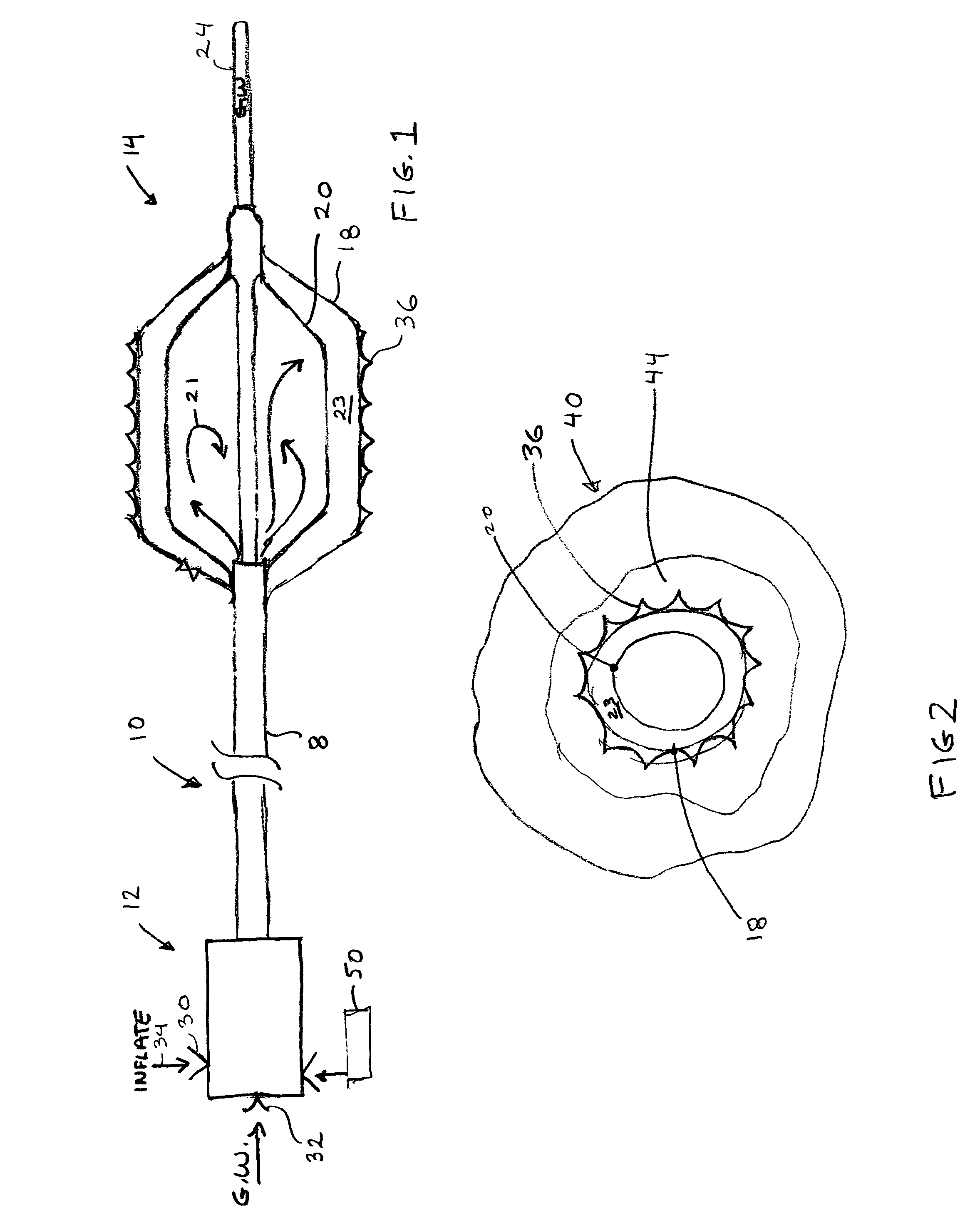 Vascular treatment method and device